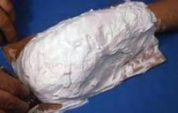 Aufbringen einer regelmässigen Schicht aus Alginatpaste auf die Handoberfläche