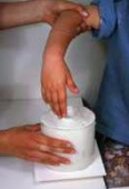 Entfernen der Hand aus der Alginatform